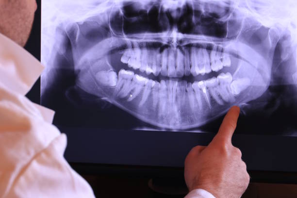 Best Broken or Cracked Tooth Emergency Dentist in Farr West, UT